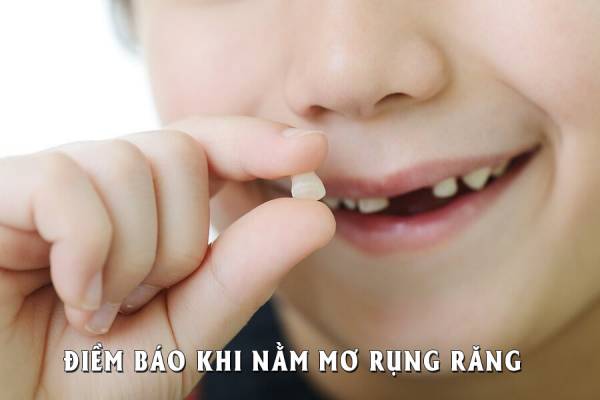 Giấc mơ rụng răng là cảnh báo cho bạn về những việc sắp xảy ra