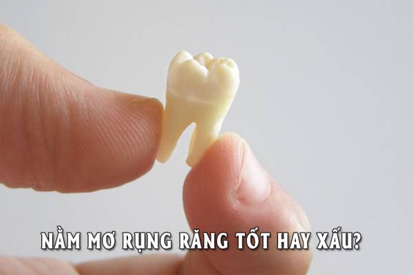 Nằm mơ rụng răng đánh con gì áp dụng trong lô đề?